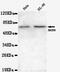 Jumonji Domain Containing 6, Arginine Demethylase And Lysine Hydroxylase antibody, MBS475005, MyBioSource, Western Blot image 