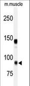 ADAM Metallopeptidase With Thrombospondin Type 1 Motif 5 antibody, LS-B9113, Lifespan Biosciences, Western Blot image 