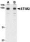 Stromal Interaction Molecule 2 antibody, TA306422, Origene, Western Blot image 