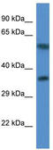 Mitochondrial Ribosomal Protein L45 antibody, TA342962, Origene, Western Blot image 