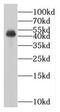 MAGE Family Member B1 antibody, FNab04941, FineTest, Western Blot image 