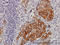 Eukaryotic Translation Initiation Factor 4 Gamma 3 antibody, LS-C133562, Lifespan Biosciences, Immunohistochemistry paraffin image 