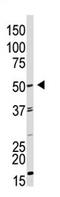 Growth Differentiation Factor 9 antibody, AP11946PU-N, Origene, Western Blot image 