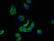 Sortilin Related VPS10 Domain Containing Receptor 1 antibody, CSB-PA848843LA01HU, Cusabio, Immunofluorescence image 