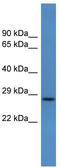 Calcyon Neuron Specific Vesicular Protein antibody, TA341984, Origene, Western Blot image 