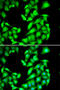 Protein Phosphatase, Mg2+/Mn2+ Dependent 1A antibody, 22-416, ProSci, Immunofluorescence image 