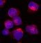 Unc-13 Homolog D antibody, MAB89661, R&D Systems, Immunocytochemistry image 