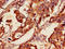Glutathione-Disulfide Reductase antibody, orb47407, Biorbyt, Immunohistochemistry paraffin image 