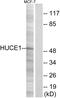 Ribosomal RNA-processing protein 8 antibody, GTX87185, GeneTex, Western Blot image 