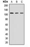 Striatin Interacting Protein 1 antibody, LS-C668512, Lifespan Biosciences, Western Blot image 