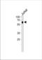 Nuclear Receptor Subfamily 2 Group C Member 2 antibody, TA324669, Origene, Western Blot image 
