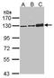 Desmoglein 2 antibody, TA308539, Origene, Western Blot image 