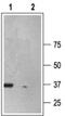 Purinergic Receptor P2X 6 antibody, PA5-77672, Invitrogen Antibodies, Western Blot image 