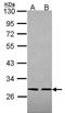 Src-like-adapter antibody, PA5-22356, Invitrogen Antibodies, Western Blot image 