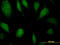 Eukaryotic Translation Elongation Factor 1 Delta antibody, LS-C197110, Lifespan Biosciences, Immunofluorescence image 