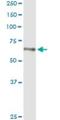 H2.0-like homeobox protein antibody, H00003142-M05, Novus Biologicals, Western Blot image 