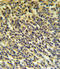 Phospholipase A2 Group VI antibody, LS-C163764, Lifespan Biosciences, Immunohistochemistry paraffin image 