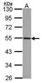 Cytochrome P450 Family 4 Subfamily A Member 11 antibody, PA5-30004, Invitrogen Antibodies, Western Blot image 