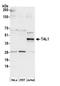 T-cell acute lymphocytic leukemia protein 1 antibody, A305-300A, Bethyl Labs, Western Blot image 