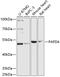 Poly(A) RNA polymerase GLD2 antibody, GTX66187, GeneTex, Western Blot image 