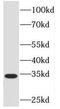 Peroxisomal targeting signal 2 receptor antibody, FNab06333, FineTest, Western Blot image 