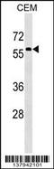 Male-specific lethal 3 homolog antibody, 59-418, ProSci, Western Blot image 
