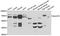 Polypeptide N-Acetylgalactosaminyltransferase 2 antibody, A04458, Boster Biological Technology, Western Blot image 