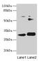 Integral Membrane Protein 2A antibody, CSB-PA011903LA01HU, Cusabio, Western Blot image 