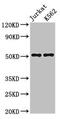 Friend leukemia integration 1 transcription factor antibody, CSB-PA008714LA01HU, Cusabio, Western Blot image 