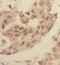 Fatty Acid Binding Protein 4 antibody, FNab02933, FineTest, Immunohistochemistry frozen image 