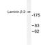 Laminin Subunit Beta 2 antibody, LS-C177176, Lifespan Biosciences, Western Blot image 