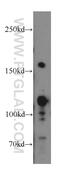 Nuclear Receptor Coactivator 3 antibody, 20032-1-AP, Proteintech Group, Western Blot image 