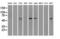 Nuclear Receptor Binding Protein 1 antibody, GTX84003, GeneTex, Western Blot image 
