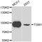 Protein-glutamine gamma-glutamyltransferase K antibody, A7343, ABclonal Technology, Western Blot image 