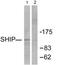 Phosphatidylinositol-3,4,5-trisphosphate 5-phosphatase 1 antibody, TA312856, Origene, Western Blot image 