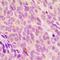 Serologically defined colon cancer antigen 8 antibody, orb304576, Biorbyt, Immunohistochemistry paraffin image 