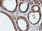 IlvB Acetolactate Synthase Like antibody, LS-C173051, Lifespan Biosciences, Immunohistochemistry frozen image 