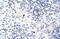 Zinc Finger And BTB Domain Containing 38 antibody, orb330093, Biorbyt, Immunohistochemistry paraffin image 