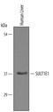 Sulfotransferase Family 1E Member 1 antibody, PA5-47751, Invitrogen Antibodies, Western Blot image 