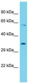 YTH N6-Methyladenosine RNA Binding Protein 1 antibody, TA344966, Origene, Western Blot image 