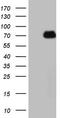Heat Shock Transcription Factor 2 antibody, TA807405S, Origene, Western Blot image 