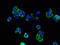 3-ketoacyl-CoA thiolase, mitochondrial antibody, orb400392, Biorbyt, Immunocytochemistry image 
