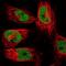 DNA repair protein complementing XP-G cells antibody, NBP2-47578, Novus Biologicals, Immunofluorescence image 