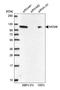 DNA replication licensing factor MCM6 antibody, HPA004818, Atlas Antibodies, Western Blot image 