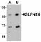 Schlafen Family Member 14 antibody, LS-C108644, Lifespan Biosciences, Western Blot image 