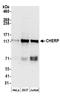 Calcium Homeostasis Endoplasmic Reticulum Protein antibody, A304-620A, Bethyl Labs, Western Blot image 
