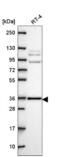 HCLS1 Associated Protein X-1 antibody, NBP2-57945, Novus Biologicals, Western Blot image 