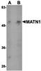 Matrilin 1 antibody, orb75187, Biorbyt, Western Blot image 