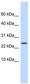 LY6/PLAUR Domain Containing 6 antibody, TA337605, Origene, Western Blot image 