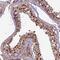 Chromosome 3 Open Reading Frame 70 antibody, NBP1-86223, Novus Biologicals, Immunohistochemistry paraffin image 